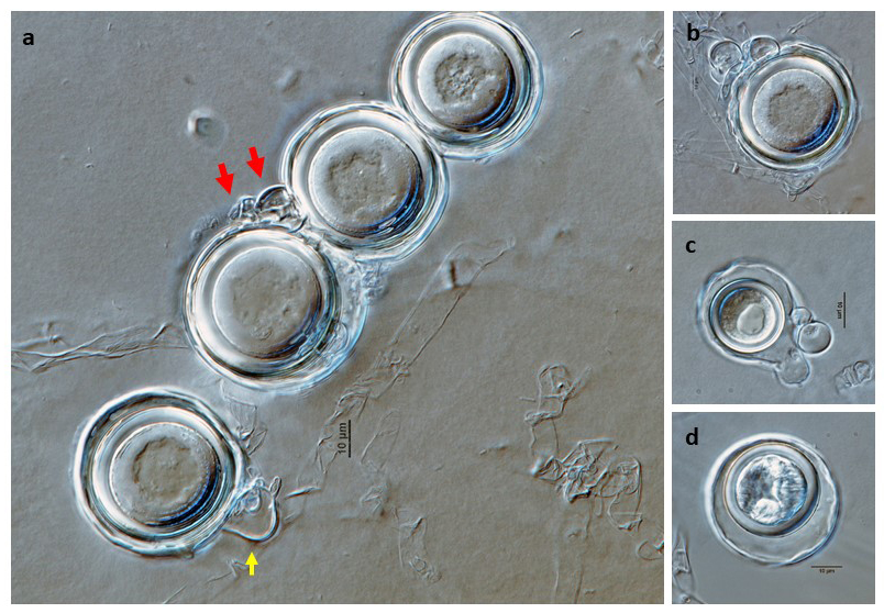   Phytophthora sansomeana  (ex-type CPHST BL 55) sexual phase: (a) oogonia with amphigynous antheridia (red arrows) and paragynous antheridium with finger-like projections (yellow arrow); oogonia with plerotic (b), and aplerotic (c, d) oospores; photos by Gloria Abad, USDA-APHIS-PPQ. 
